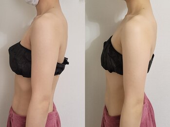 ティティビューティ ラ・クエージ金山(TTBeauty)/