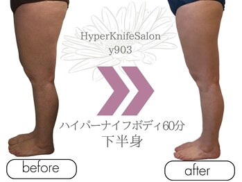 ワイキューマルサン(y903)/ハイパーナイフボディ60分下半身