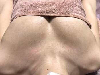 ネイト ワックス(Neit Wax)の写真/痩せながらバストアップ◎ぜい肉をバストへ持ってくる!