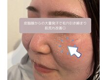 ヨサパーク スリー 西日暮里(YOSA PARK three)の雰囲気（お肌のトラブルもお任せください！）