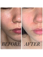 プリマ(Prima) フェイ シャル