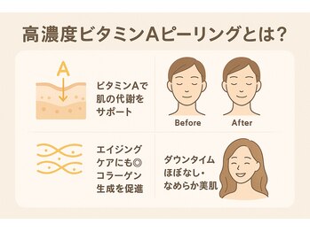 おうちサロン ミキ/ビタミンAピーリングとは
