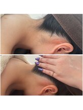 ミース 北九州店/うなじ△ビフォーアフター