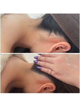 ミース 北九州店/うなじ△ビフォーアフター