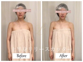 リノ(Lino)/上半身リリースカッターB&A