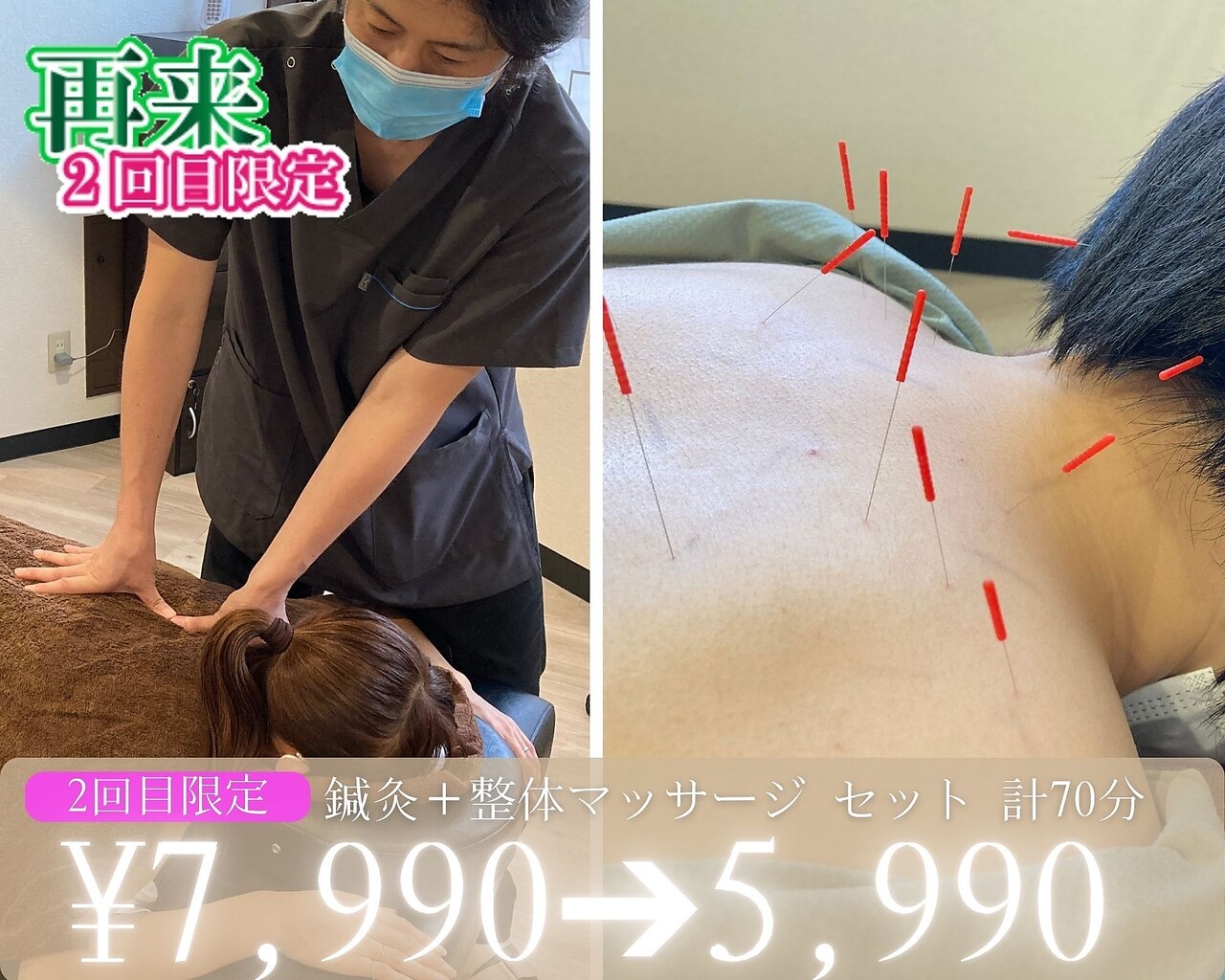 【2回目限定】鍼灸＋マッサージ 頭痛/肩こり改善セット 計70分★\7990→\5990