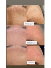 フットミー(foot mii)/