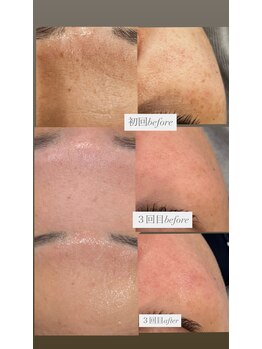 フットミー(foot mii)/