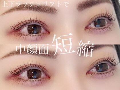 シュシュ(Shu Shu)の写真