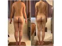 エステティック リオン(Rion)/ビフォーアフター