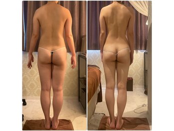 エステティック リオン(Rion)/ビフォーアフター