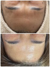 サロンニーナ(Salon.Nina)/韓国肌管理セルマン