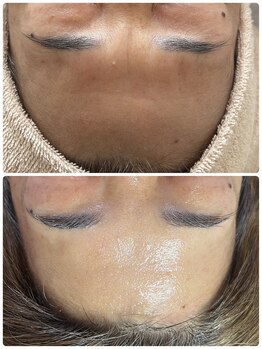 サロンニーナ(Salon.Nina)/韓国肌管理セルマン