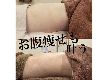 トータルエステティック ジョワイユ(JOYEUX)の写真