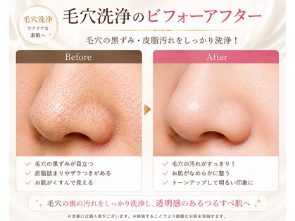 リノ 天神大名店(Lino)の写真