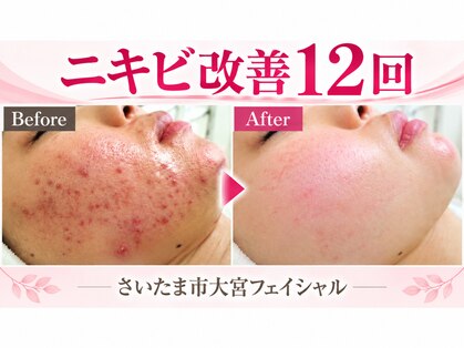 サロンドエステケイワイ(de KY)の写真