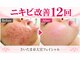 サロンドエステケイワイ(de KY)の写真