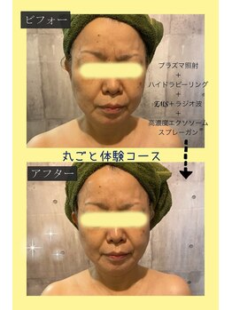 ランプ(Lampe)/◇ハイドラシャイン丸ごと体験