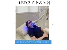 ホワイトニングショップ 明石大久保店/◎LEDライトで照射スタート