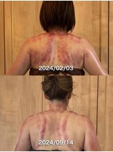 ラウレア(LAULEA)/背中すっきり！セルクラ上半身。