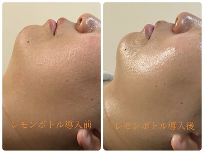 グラン ジュテの写真