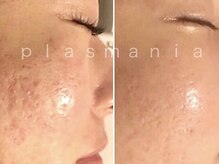 ユアン(YUAN)/お肌のそのお悩み任せてください