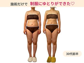 ラルーエ 仙台/施術だけで服にゆとりが!!