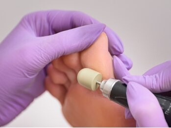 リフト(Re:ft)の写真/プロによる徹底したケアで足裏・かかとのガサガサを解消し、滑らかに整え美しい素肌へ【角質ケア￥4400～】