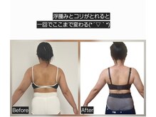 ステラ(Stella)/【痩身】ボディリンパマッサージ