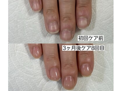 ネイルサロンアンドスクール マルベリー(mulberry)の写真