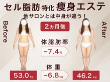 ラ パルレ 松本店の雰囲気（脚ケア/温熱ケア/セル脂肪/めぐり/ボディケア）