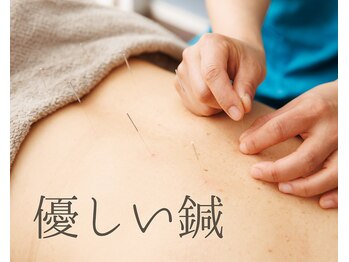 バックステージ鍼灸院(Backstage鍼灸院)の写真/肩こり腰痛だけでなく、内臓にまで効果的な内臓鍼灸。主に手足のツボを使ってみるみるお腹が緩みます！