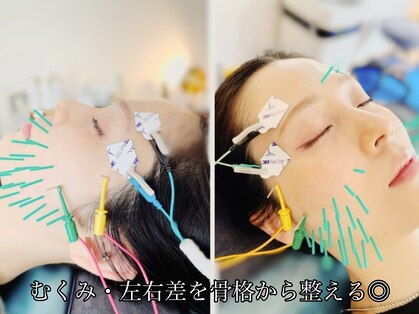 アオヤマ サロン ワイゼット(AOYAMA SALON YZ)の写真