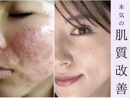 リッド(RID)の写真