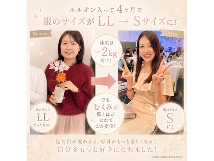 ヨサパーク リープ(YOSA PARK Leap)の写真