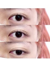 ビーティー(bT)/