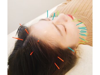 おもいやり鍼灸治療院 モーイ(mooi)/美容鍼で肌質改善