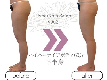 ワイキューマルサン(y903)/ハイパーナイフボディ60分下半身