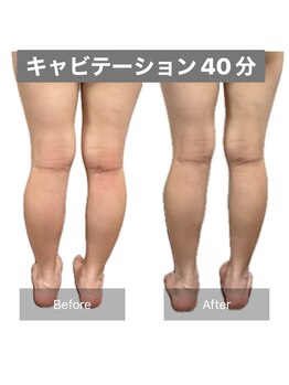 アネモネ/ダイエット/痩身/腸活/耳つぼ