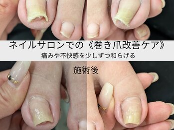ヴィスターネイル 赤坂店(Vistar nail)/