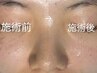 当日カウンセリングでメニューを決めたい方《1メニュー》