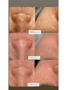 フットミー(foot mii)/