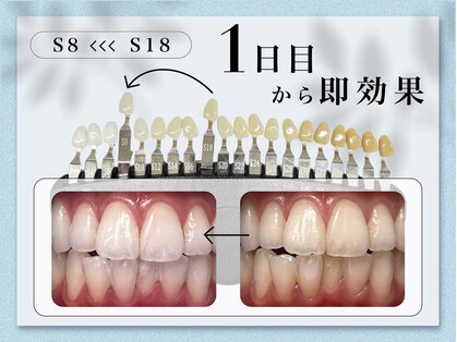 ハイティース 高田馬場店(Hi Teeth!)の写真