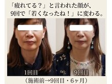 りんぱサロン まり