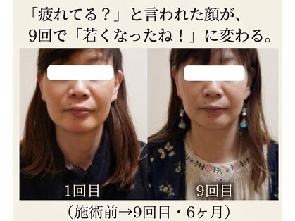 りんぱサロン まりの写真