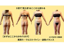 プライベートサロン やすらぎ/エンダモロジー姿勢で美ライン♪