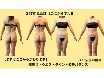 プライベートサロン やすらぎ/エンダモロジー姿勢で美ライン♪