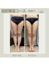 FJ/下半身痩せのお客様