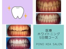 ポノケアサロン(PONO KEA SALON)