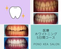 ポノケアサロン(PONO KEA SALON)